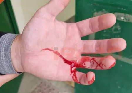 corte mano