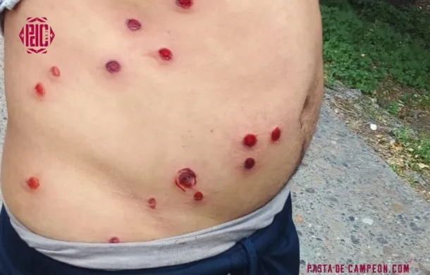 futbol incidentes balas de goma