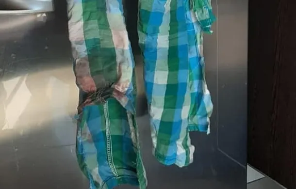 san blas pantalon nena ataque perros